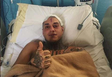 Francesco Chiofalo, il tumore al cervello e le conseguenze "devastanti" della radioterapia: come sta oggi