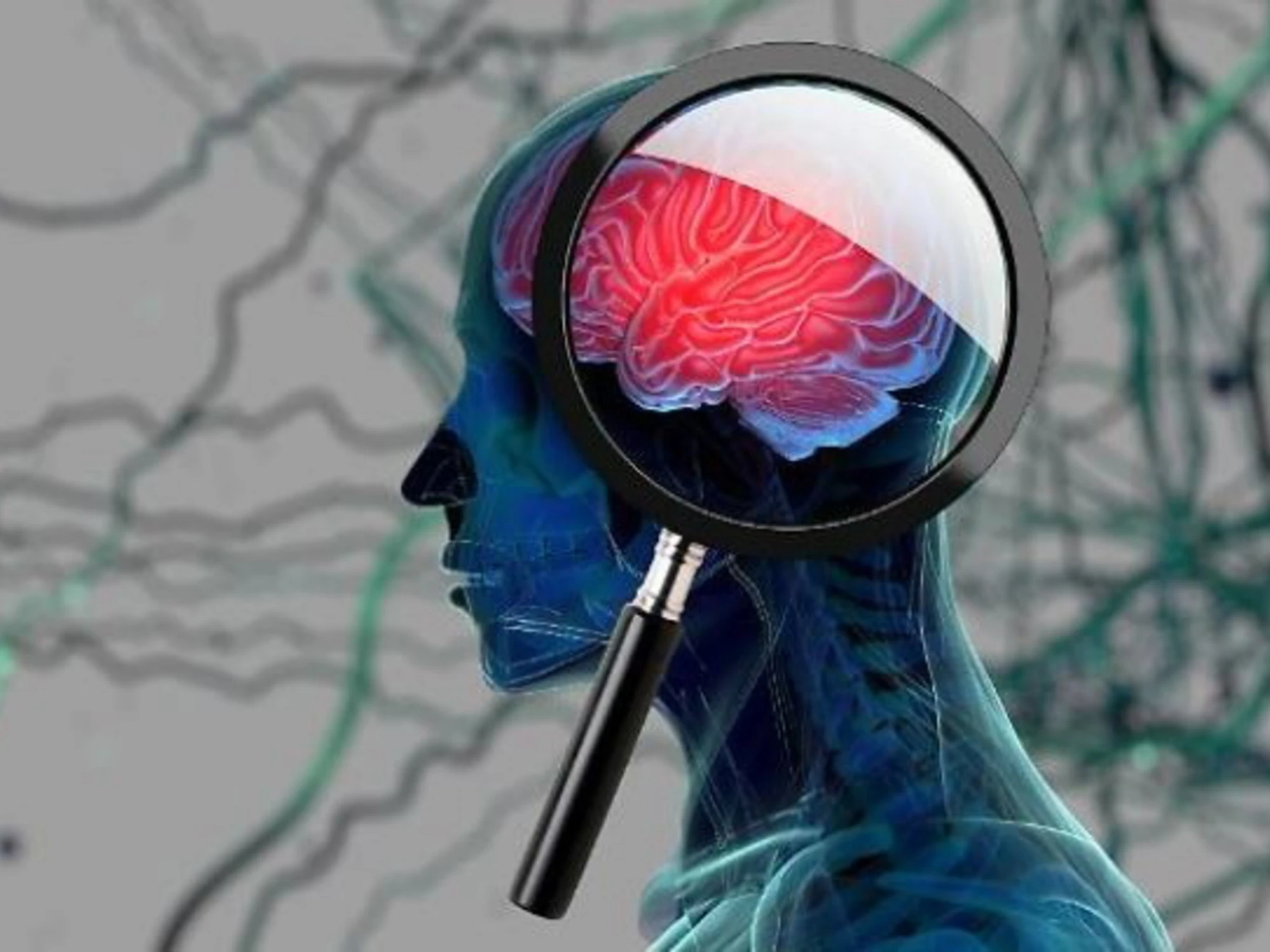 Alzheimer e sogni, il legame tra malattia e regno onirico