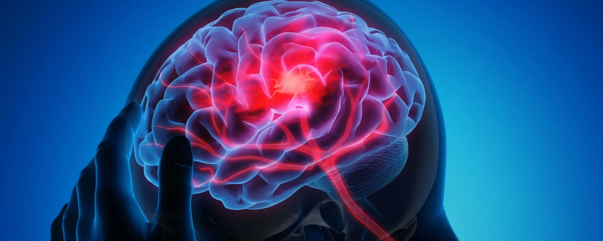 Tossina botulina, ecco come aiuta a combattere l'emicrania cronica