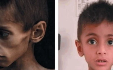 Fatto Quotidiano, la grande bufala del bimbo che muore di fame a Gaza: è in Italia da giugno