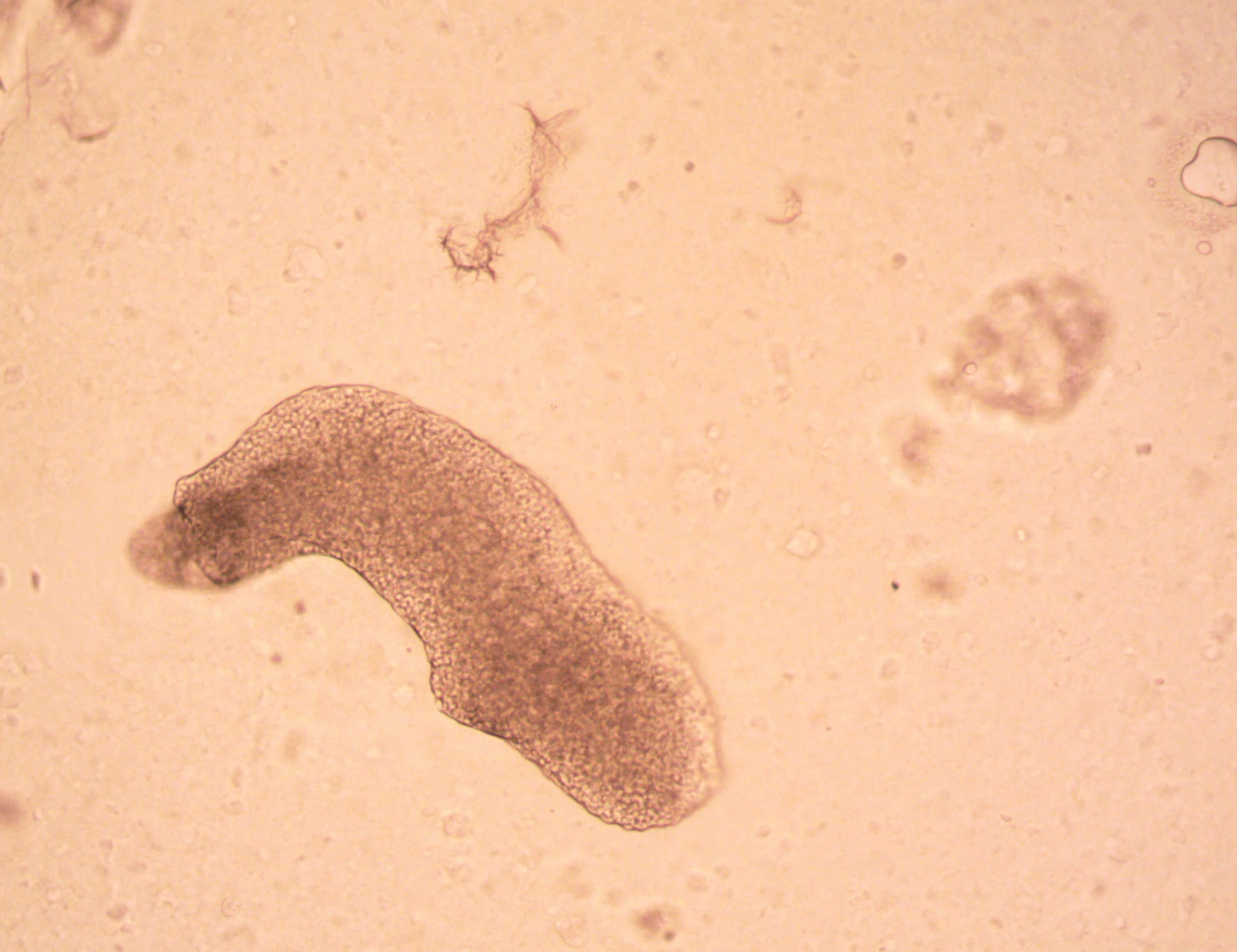 Salmonella nelle mense italiane, "alimento sospeso immediatamente"