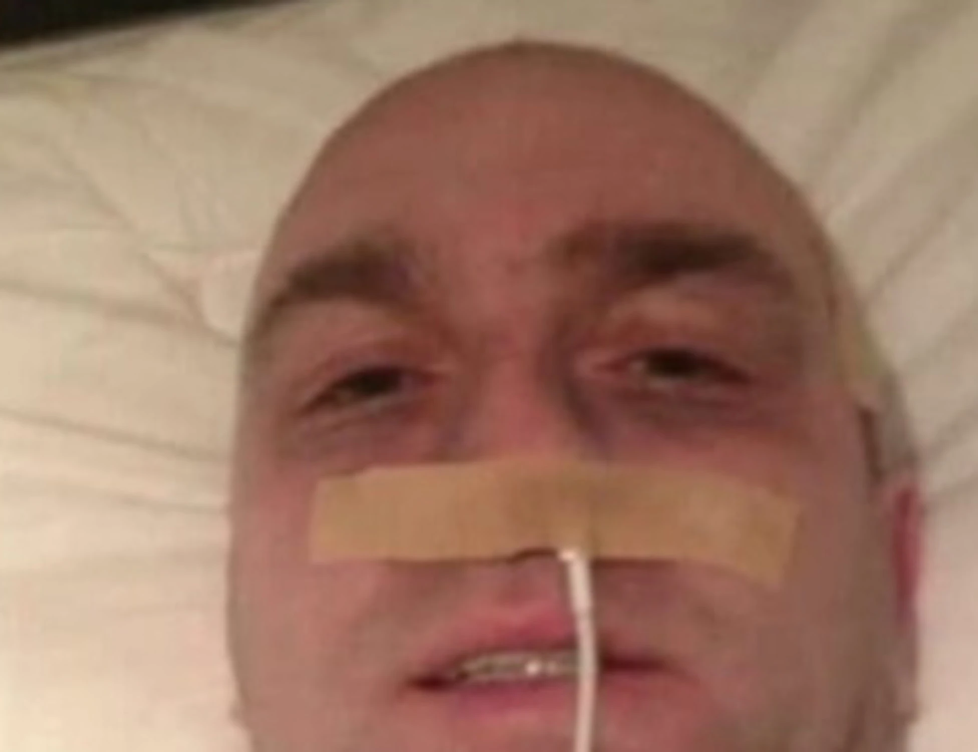Irlanda, finge di avere un cancro per raccogliere soldi: chi è quest'uomo