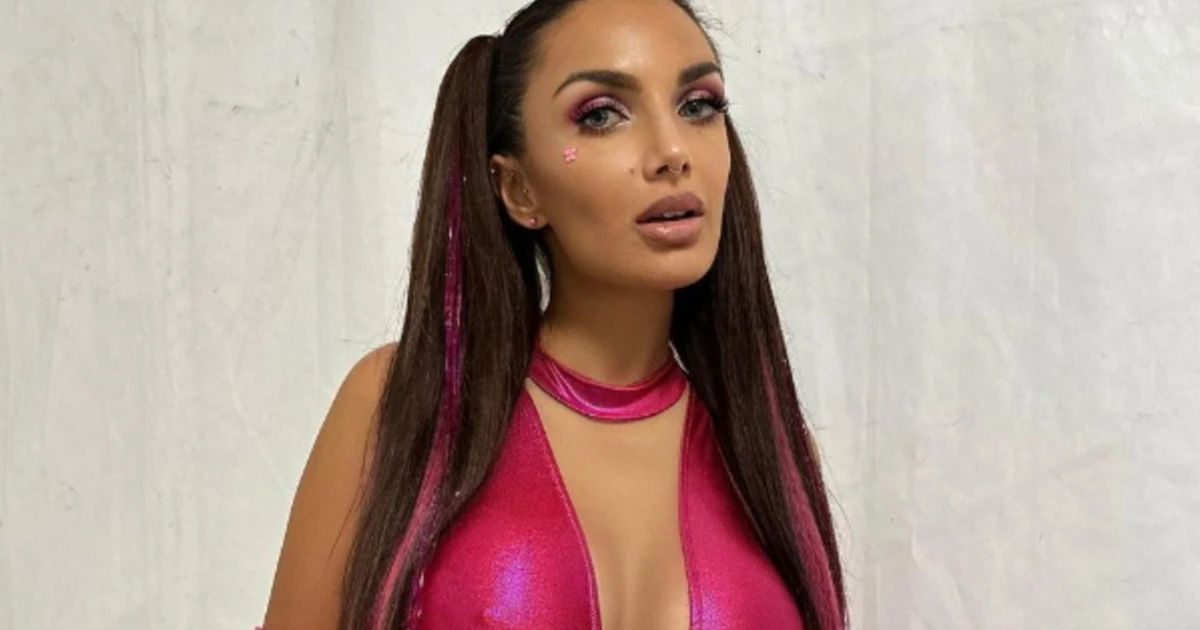 Elettra Lamborghini, la foto svela il dramma: "Le mie braccia hanno un problema"