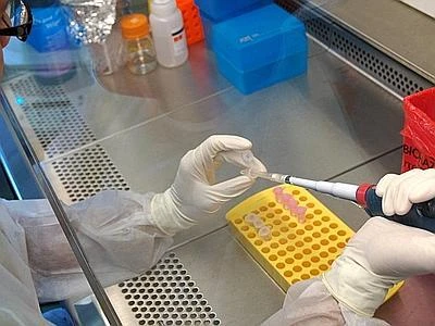 Usa, contagiato l'infermiere che curò il paziente zero