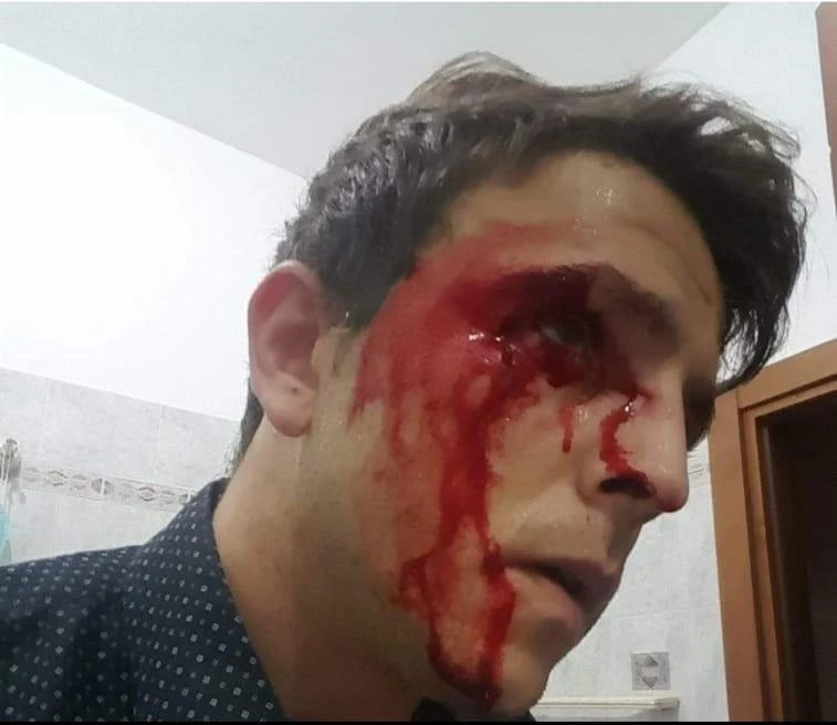 Giorgia Meloni, foto choc del dirigente di Fratelli d'Italia aggredito: come l'hanno ridotto