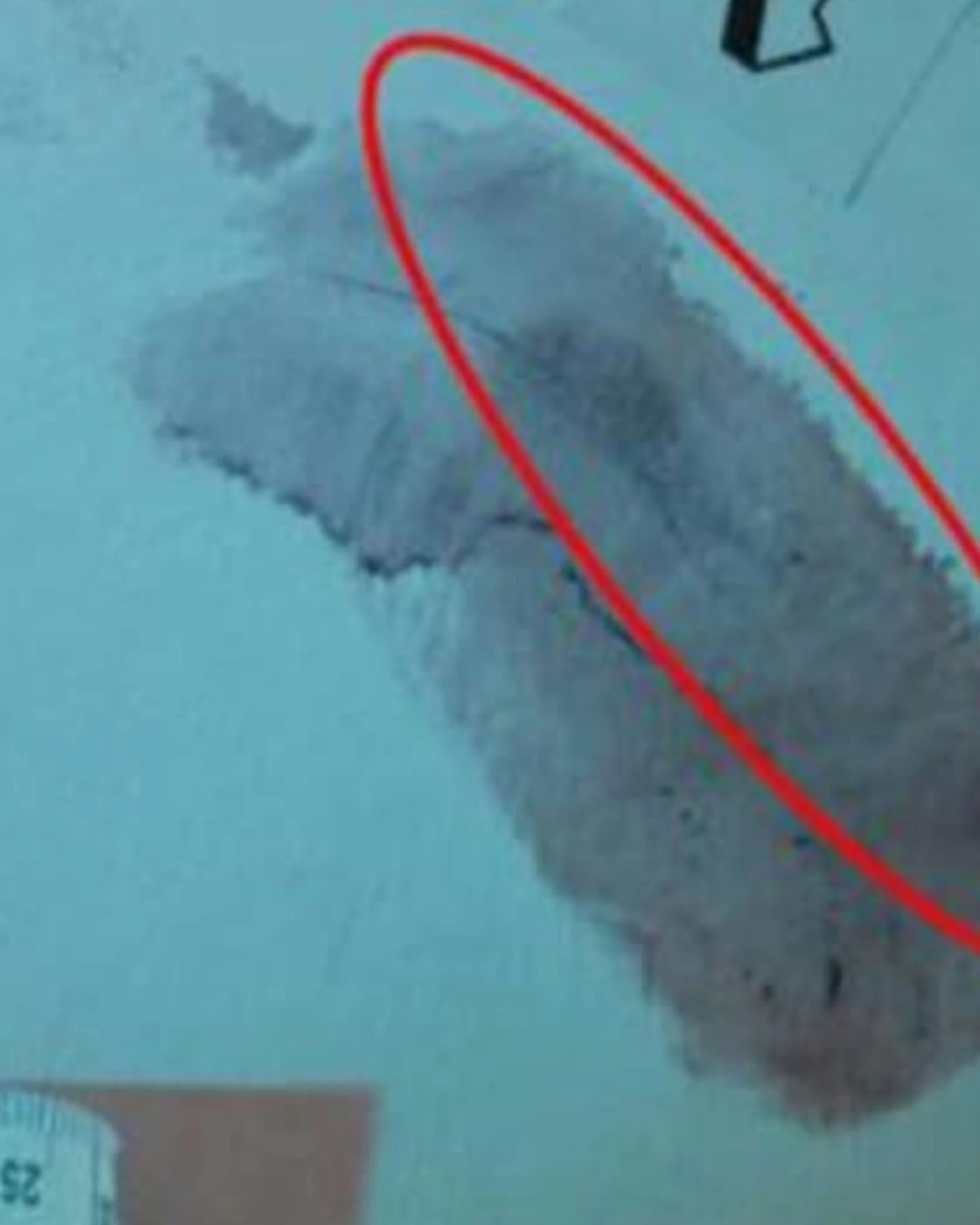 Garlasco, la scoperta sull'impronta 33: perché ora crolla il caso
