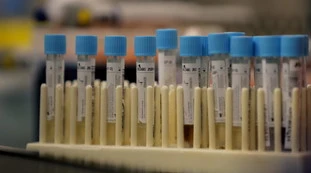 Coronavirus, lo studio choc dagli Usa: "Durerà altri 18-24 mesi"