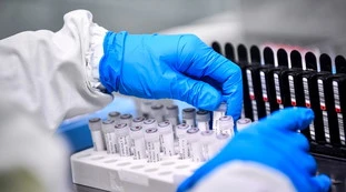 Coronavirus, il bollettino del 12 maggio: 172 morti, cala la curva di decessi e ricoverati. Ma c'è l'incognita Lombardia
