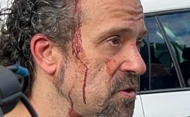 Modena, parla l'uomo che ha fermato il 31enne: "Blaterava qualcosa, poi mi ha accoltellato"