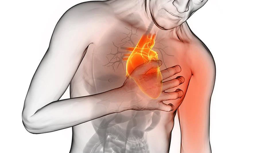 Infarto, ecco gli otto segni premonitori: come puoi salvarti la vita
