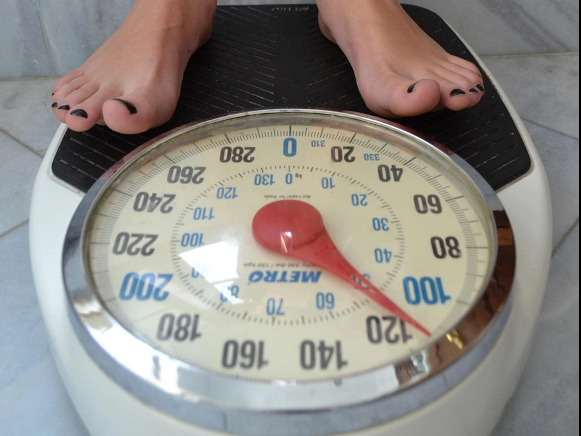 I pericoli dell'obesità e la sindrome ipocinetica