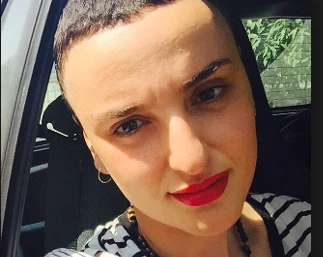 Arisa, la verità dietro il taglio di capelli cortissimo: "Soffro di tricotillomania"