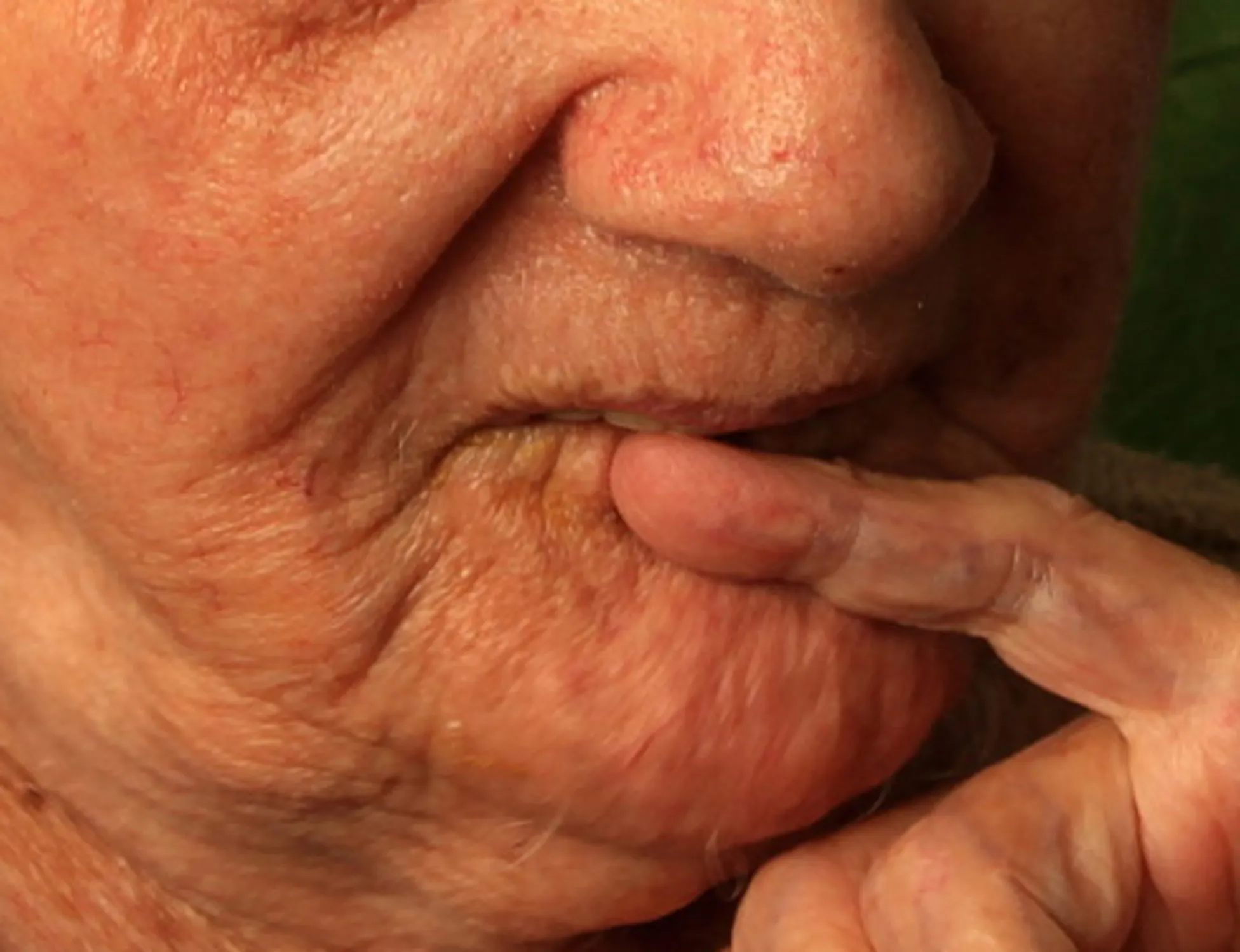 Leggi l'articolo: Abusi sessuali su una 86enne malata di Alzheimer: orrore a Milano, rumeno arrestato