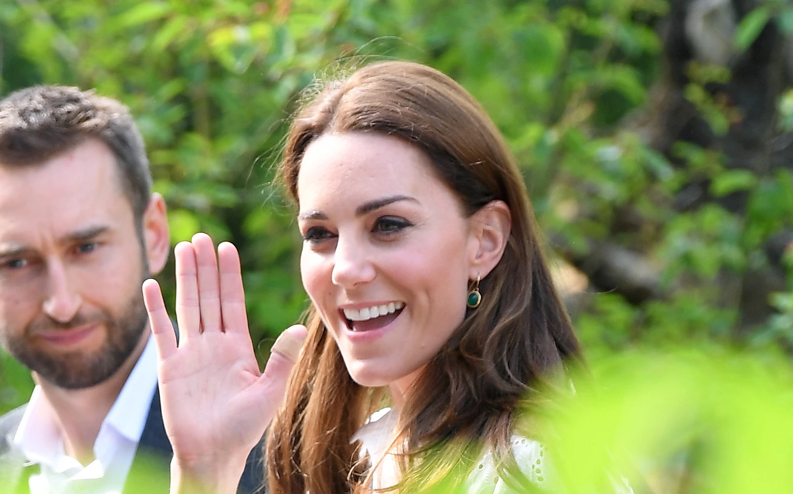 Kate Middleton, il mistero dei cerotti sul suo corpo: cosa c'è dietro quelle ferite