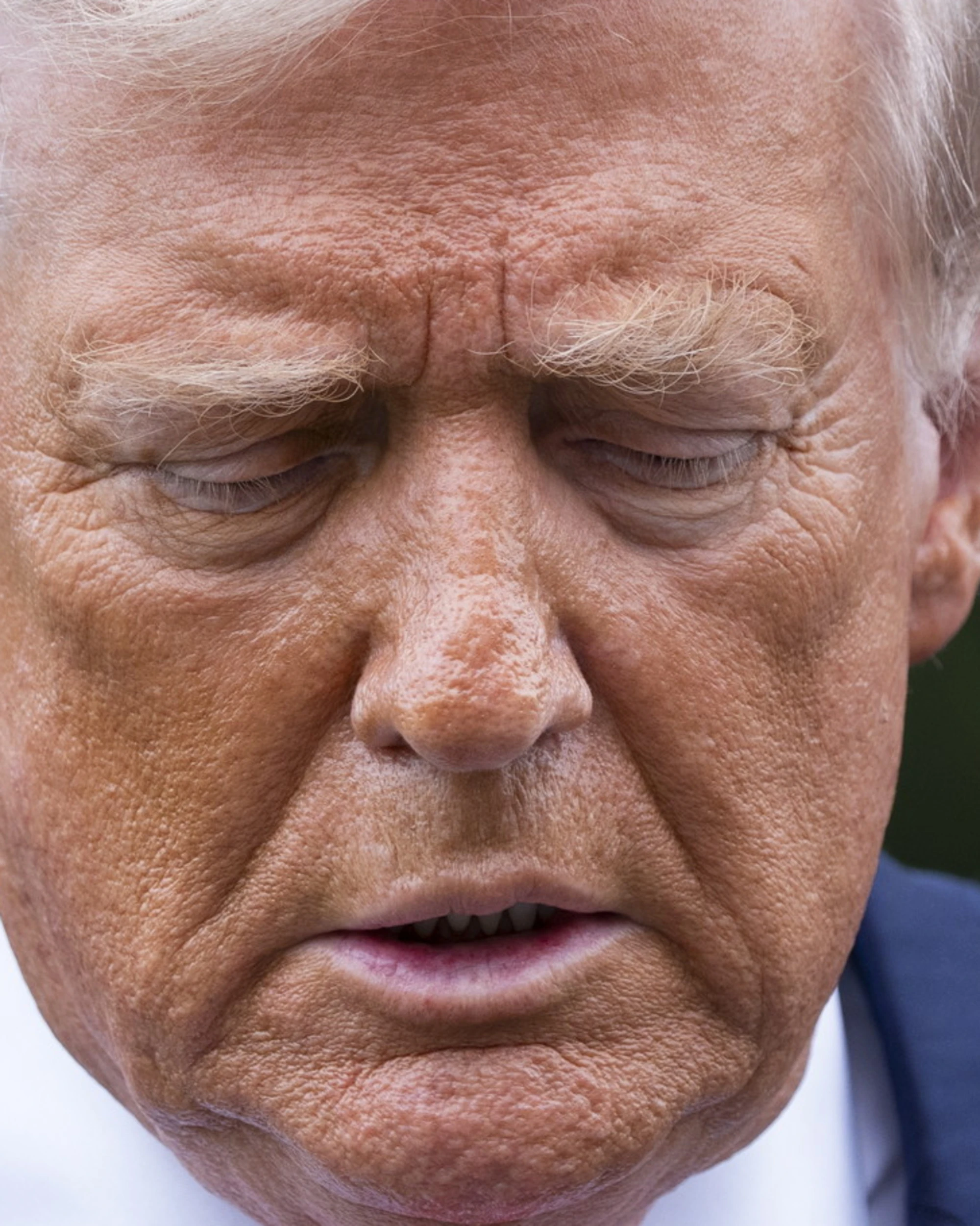 "Trump ha un'insufficienza venosa cronica": la Casa Bianca rompe il silenzio