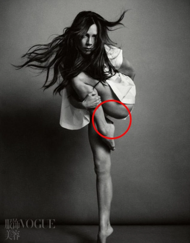 Vedete questa foto di Victoria Beckam? Dettaglio sconcertante, ecco cos'ha tra le gambe