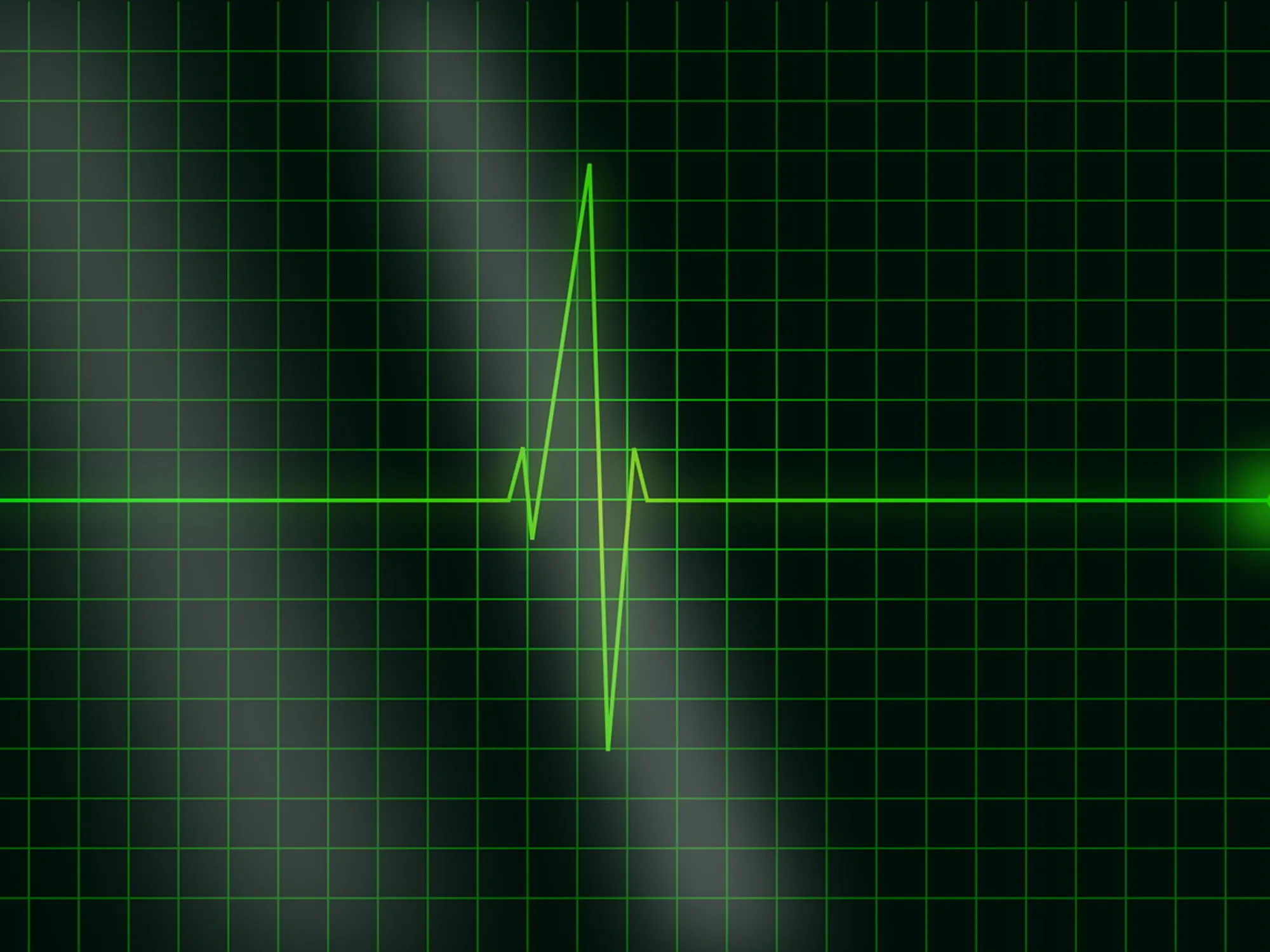 Leggi l'articolo: Pennichella di 15 minuti dopo pranzo per salvare il cuore