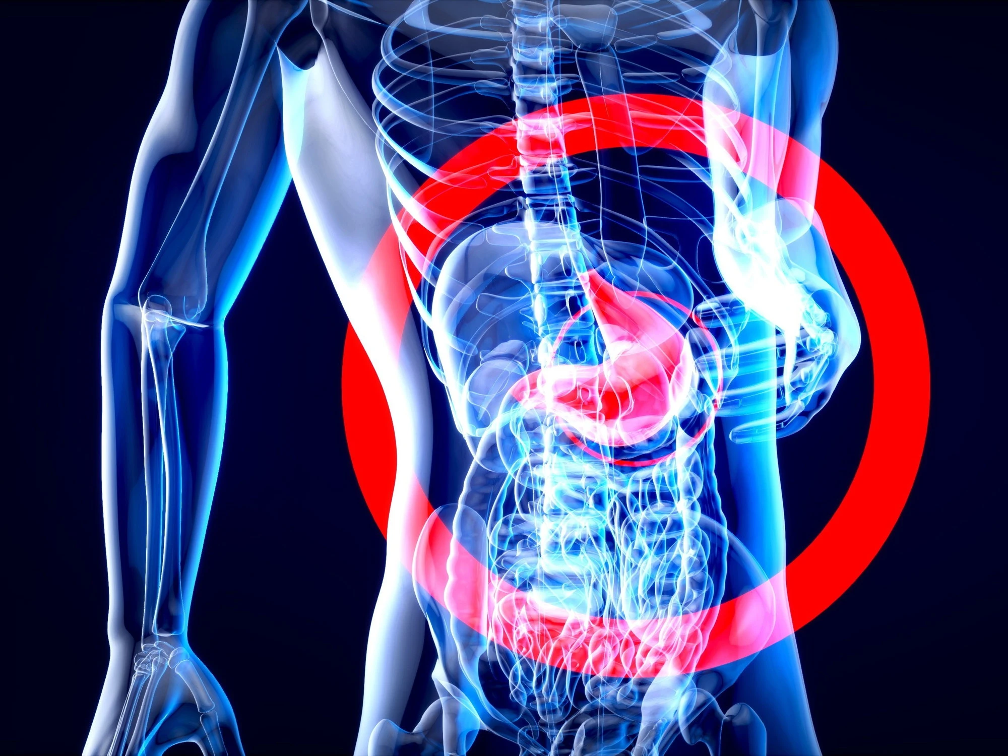 Reflusso gastrico, attenzione ai farmaci: cosa evitare