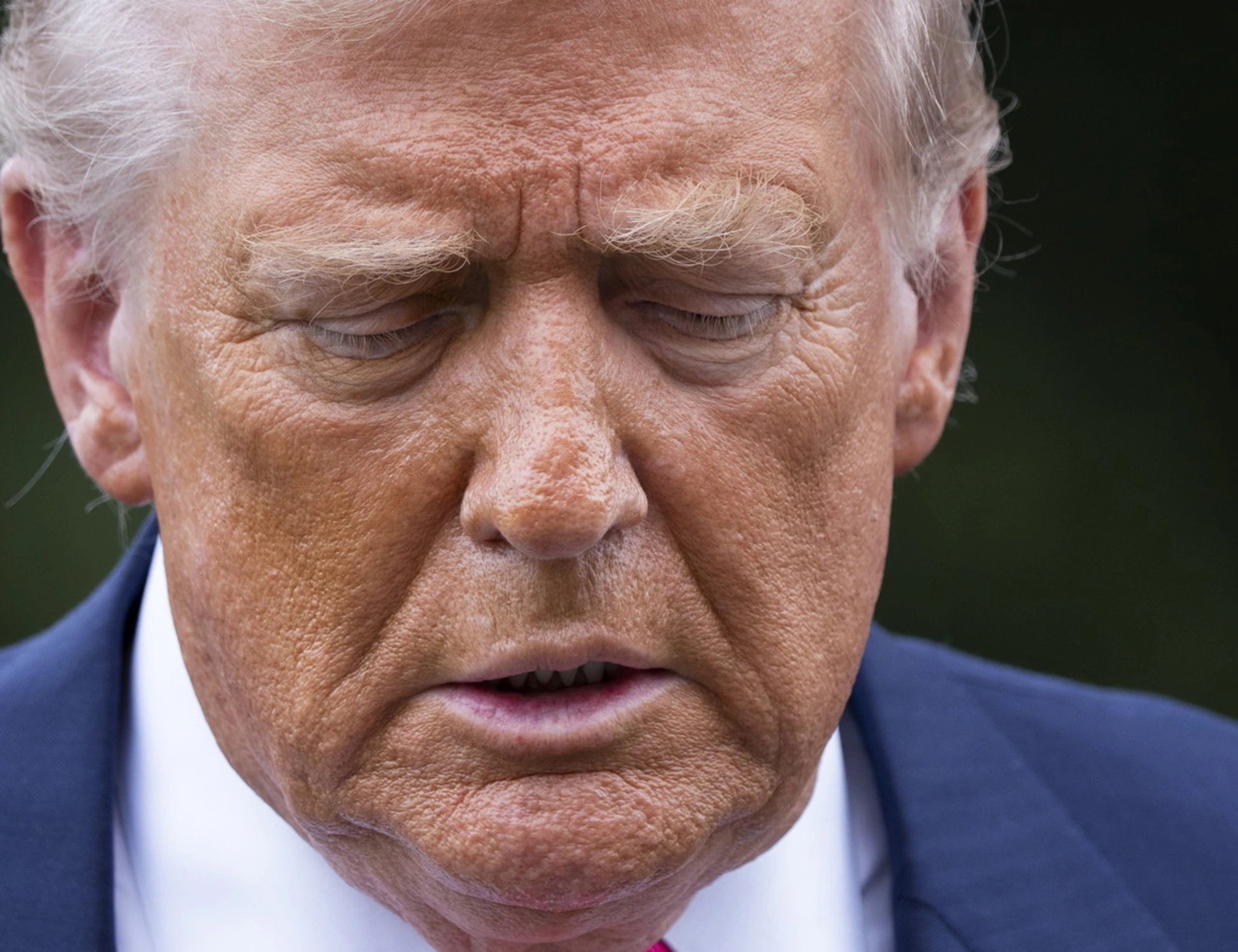 "Trump ha un'insufficienza venosa cronica": la Casa Bianca rompe il silenzio