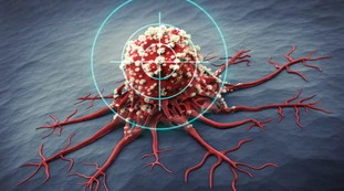 Cancro, un test casalingo immediato per scoprire la malattia con una goccia di sangue