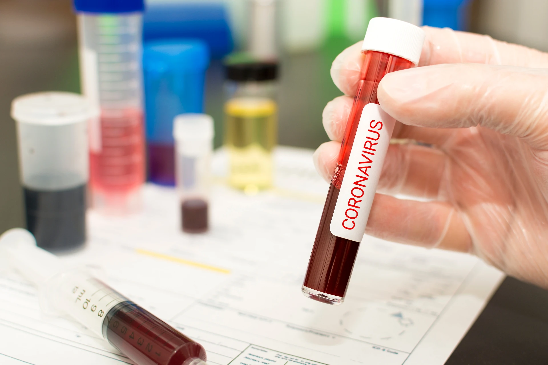 Coronavirus, a rischio il 60% della popolazione: "L'emergenza sarà l'Africa, riuscirà a contenere i contagi?"