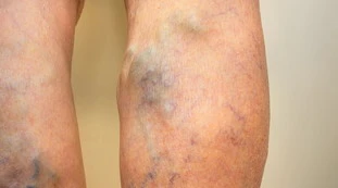 Coronavirus, gli effetti del lockdown: in questa foto, il danno gravissimo al nostro corpo