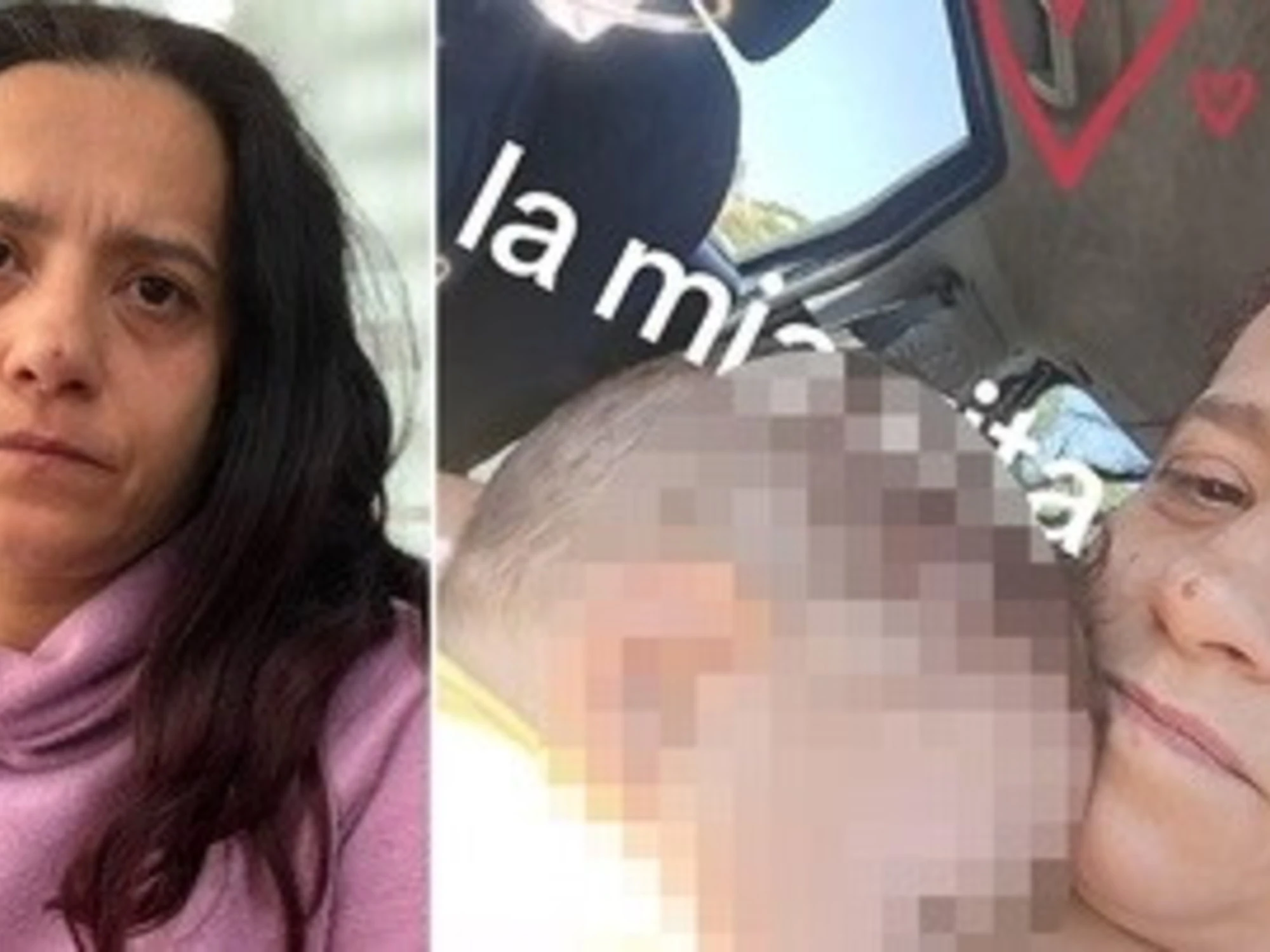 Bimbo col cuore bruciato, "10% di possibilità per il nuovo trapianto"