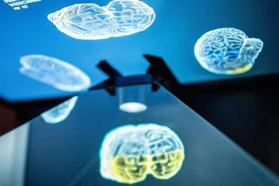 Vivere con mezzo cervello si può, "lui si riorganizza"