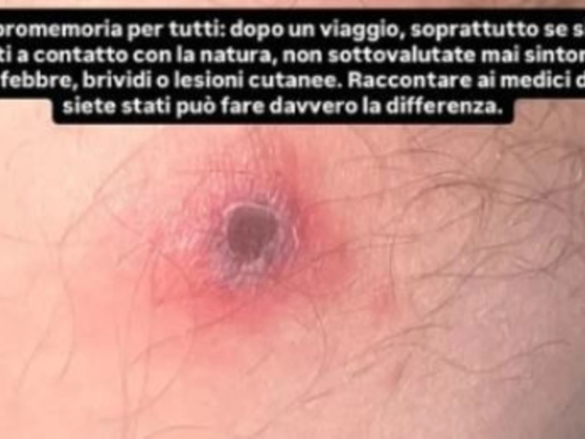 Le Iene, il dramma di Stefano Corti: "Pensavo fosse un pelo incarnito..."