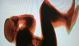 300x176