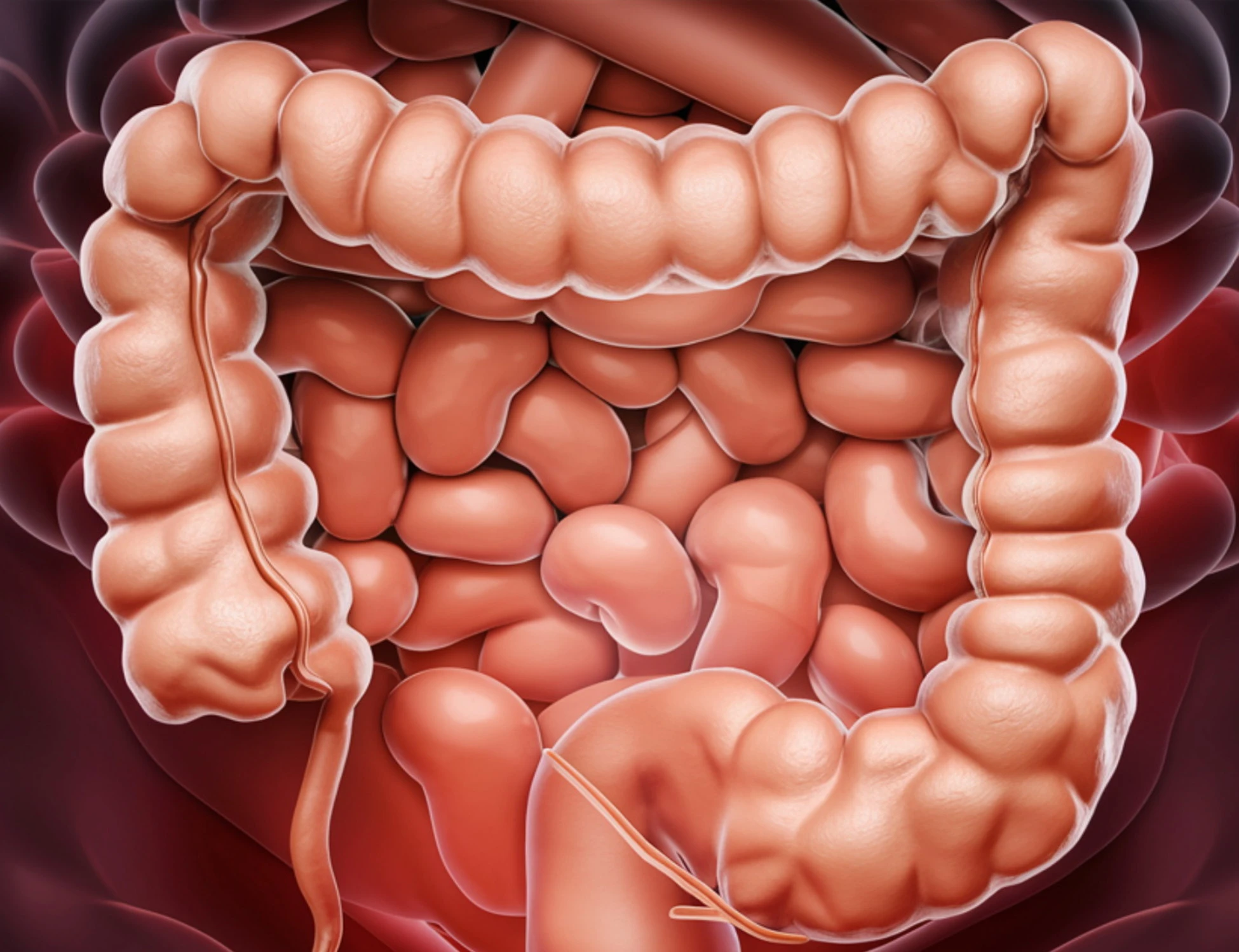 Tumore al colon e intestino giovane: la ricerca che cambia tutto