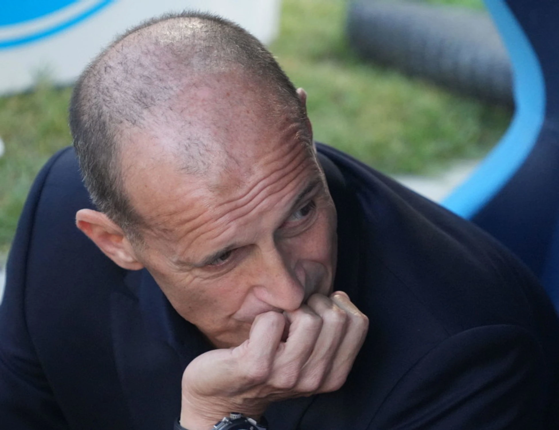 Max Allegri perde la calma: cosa è successo nello spogliatoio del Napoli