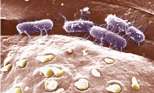 Salsicce contaminate da salmonella, il Ministero ritira un lotto