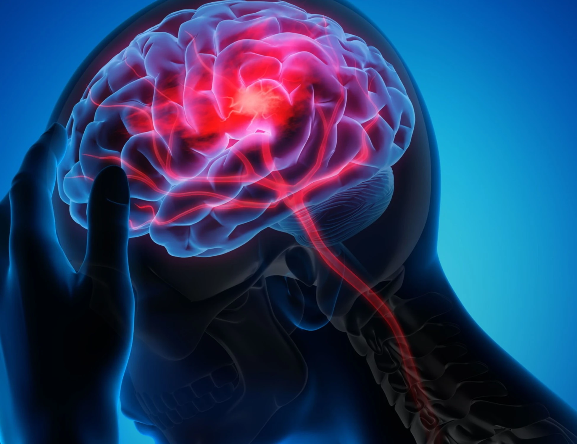 Tossina botulina come aiuta a combattere l'emicrania cronica