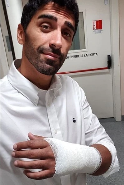 Filippo Magnini investito da un'auto passata col rosso: polso fratturato