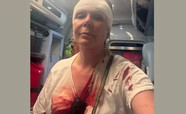 Portomaggiore, massacrata di botte da un marocchino: era a spasso col cane