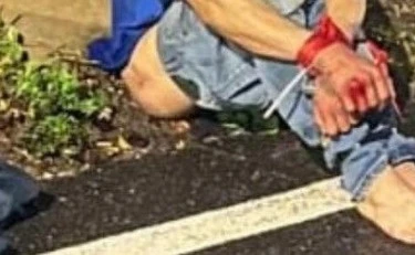 Roma, orrore fuori dal campo rom: seminudo, legato e ridotto così. La foto-choc