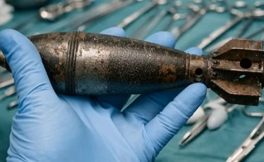 Tolosa, in ospedale con una bomba nel retto: il gioco erotico finisce in tragedia