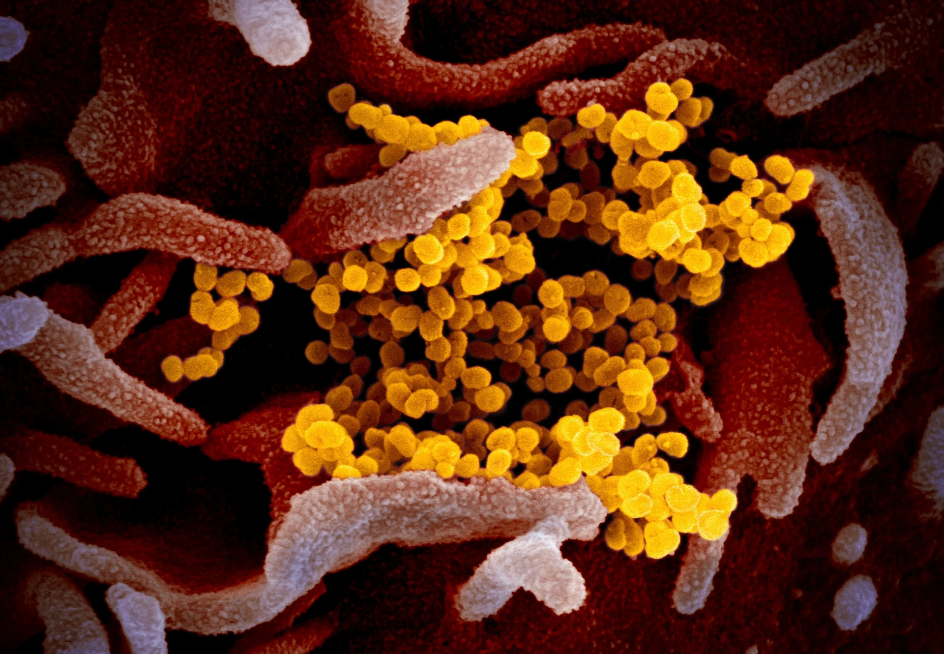 L'Oms: il coronavirus non rallenta. Per gli esperti è impossibile dire quando finirà
