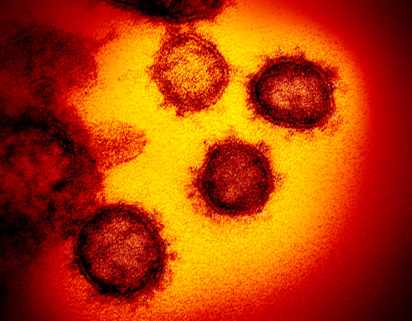 Coronavirus, l'Oms non crede più alla Cina: "Esulta per il calo dei contagi? Serve cautela, è troppo presto"