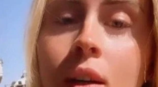 Valentina Ferragni, il dramma: "Tumore maligno, quella cicatrice non se ne andrà", un segno indelebile sul volto