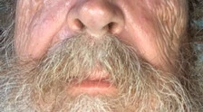 Giuliano Ferrara e la foto del volto tumefatto: "Come mi hanno ridotto quegli squadristi"