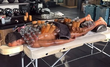 Lois Openda e il "cupping": Juve, tentativo disperato per farlo risorgere