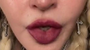 Madonna, le immagini che sconvolgono i fan: come si è ridotta a 63 anni. Labbra e seno, irriconoscibile