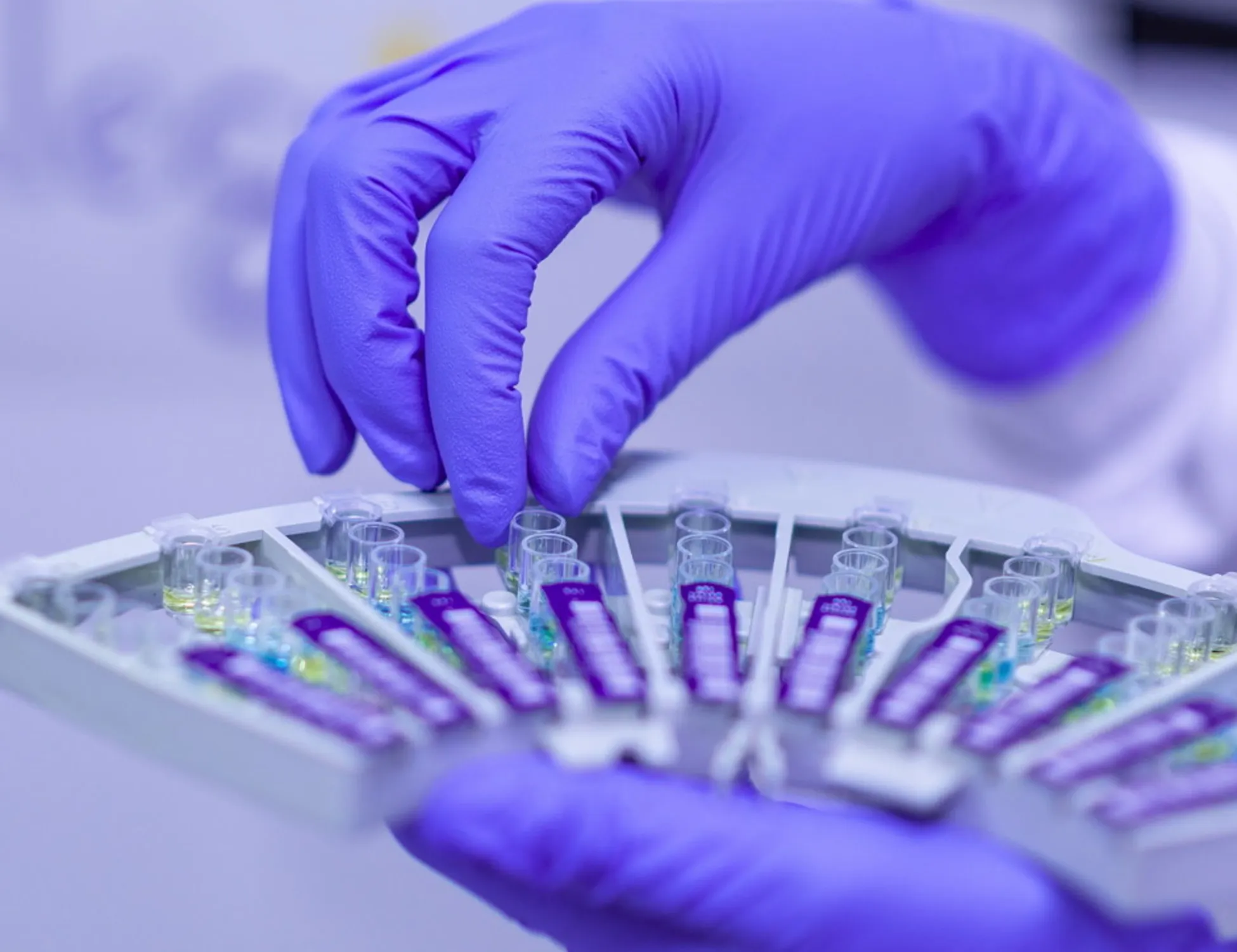 Mesotelioma scoperti quattro profili molecolari che prevedono l'efficacia dell'immunoterapia