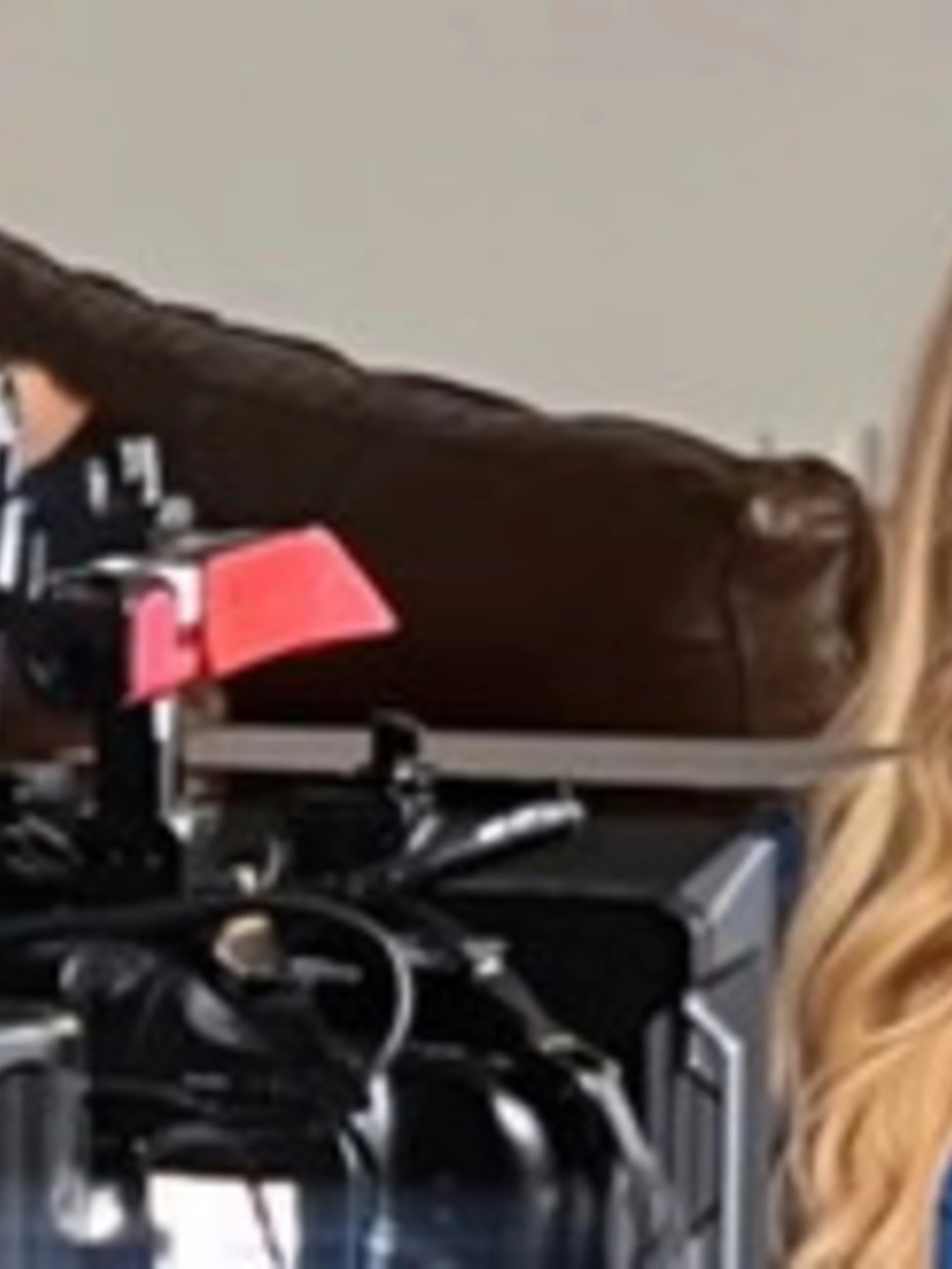Brandi Glanville, il volto della star sfigurato da un parassita