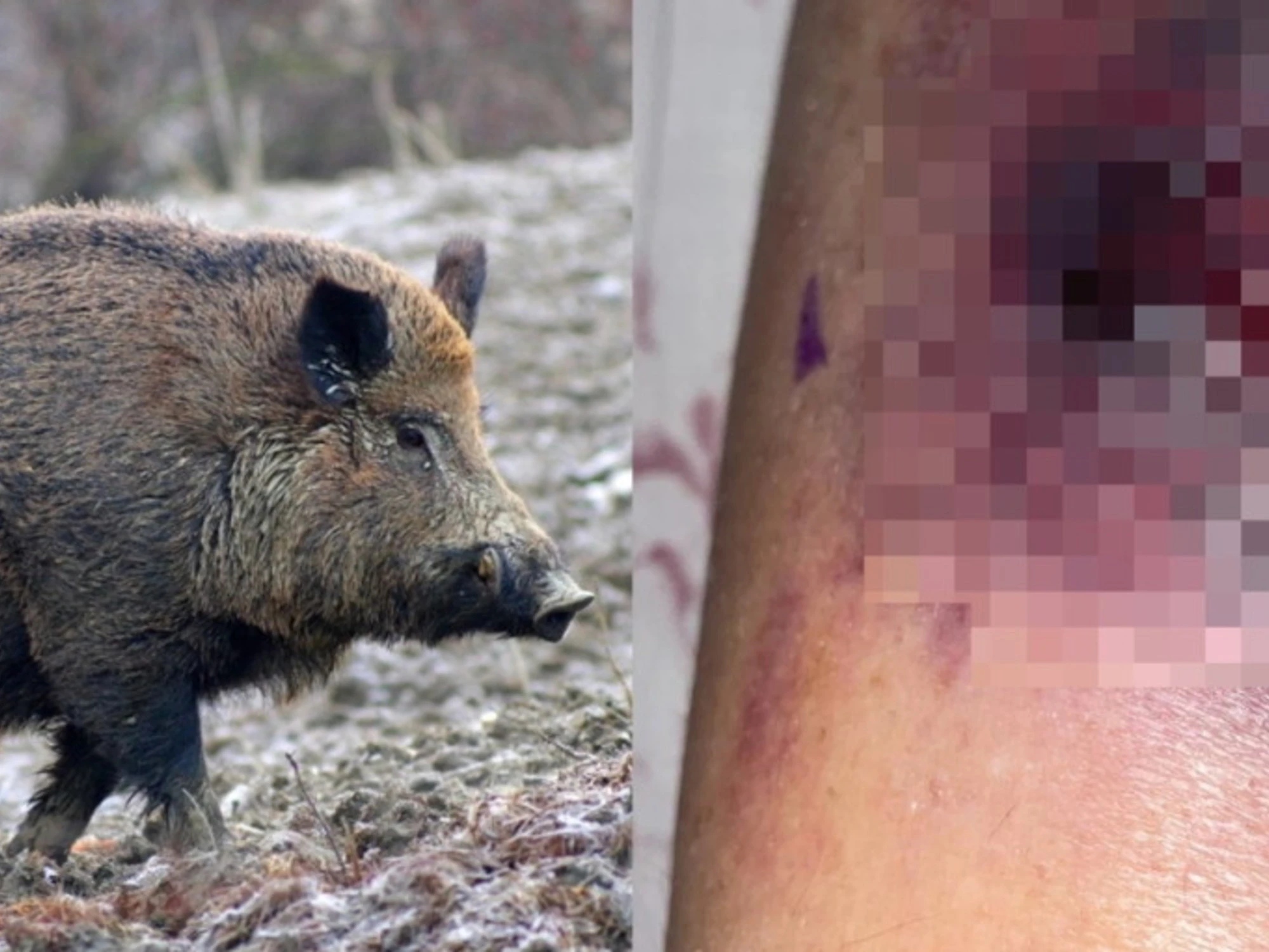 Formello, esce di casa e viene attaccata da un cinghiale: il dramma di Maura