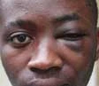 Giovane ghanese picchiato