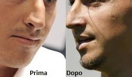 Il prima e dopo di Ibra