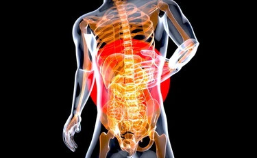 Sclerosi multipla, i 2 batteri intestinali che innescano la malattia